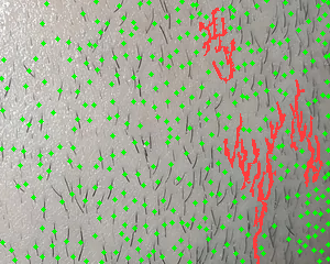 The same patch with a green dot marking every hair BeardLog counted