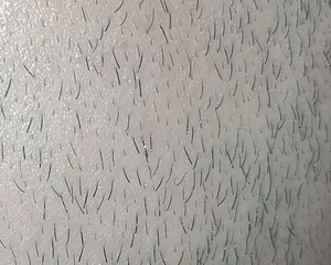Close-up of real beard hairs on skin, before analysis